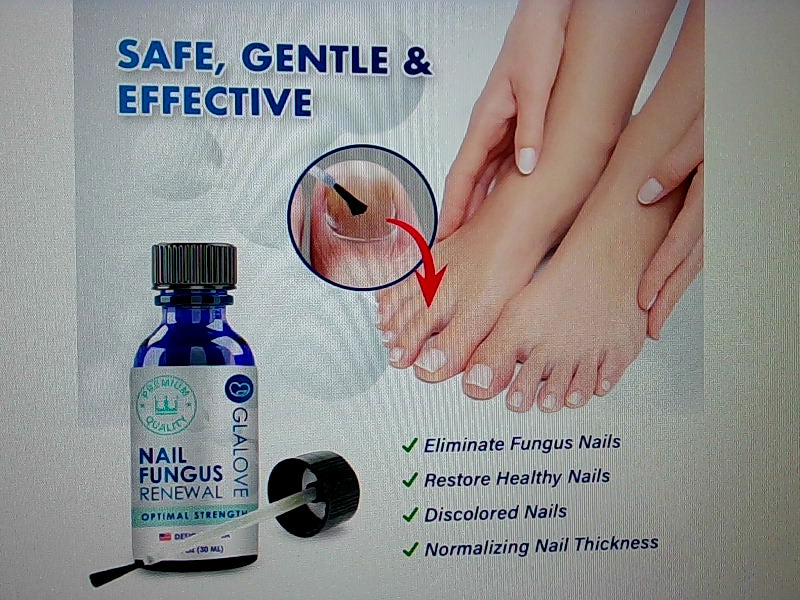 GLALOVE Nail Fungus Renewal Treatment 30 ml